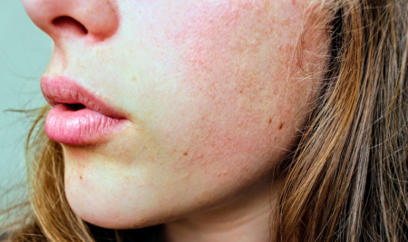 Pelle sensibile: come costruire una skincare semplice e delicata